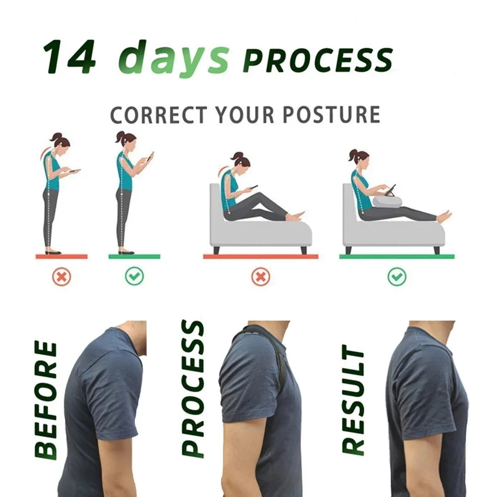 Back Posture Corrector Belt Brace Hunchback Corrector Adult Men and Women