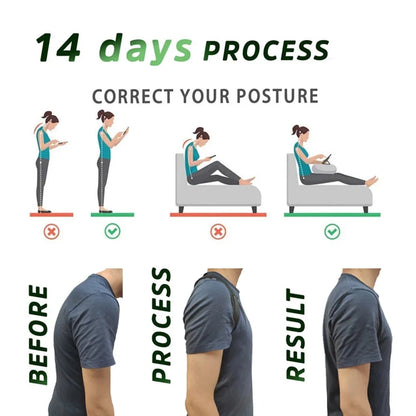 Back Posture Corrector Belt Brace Hunchback Corrector Adult Men and Women