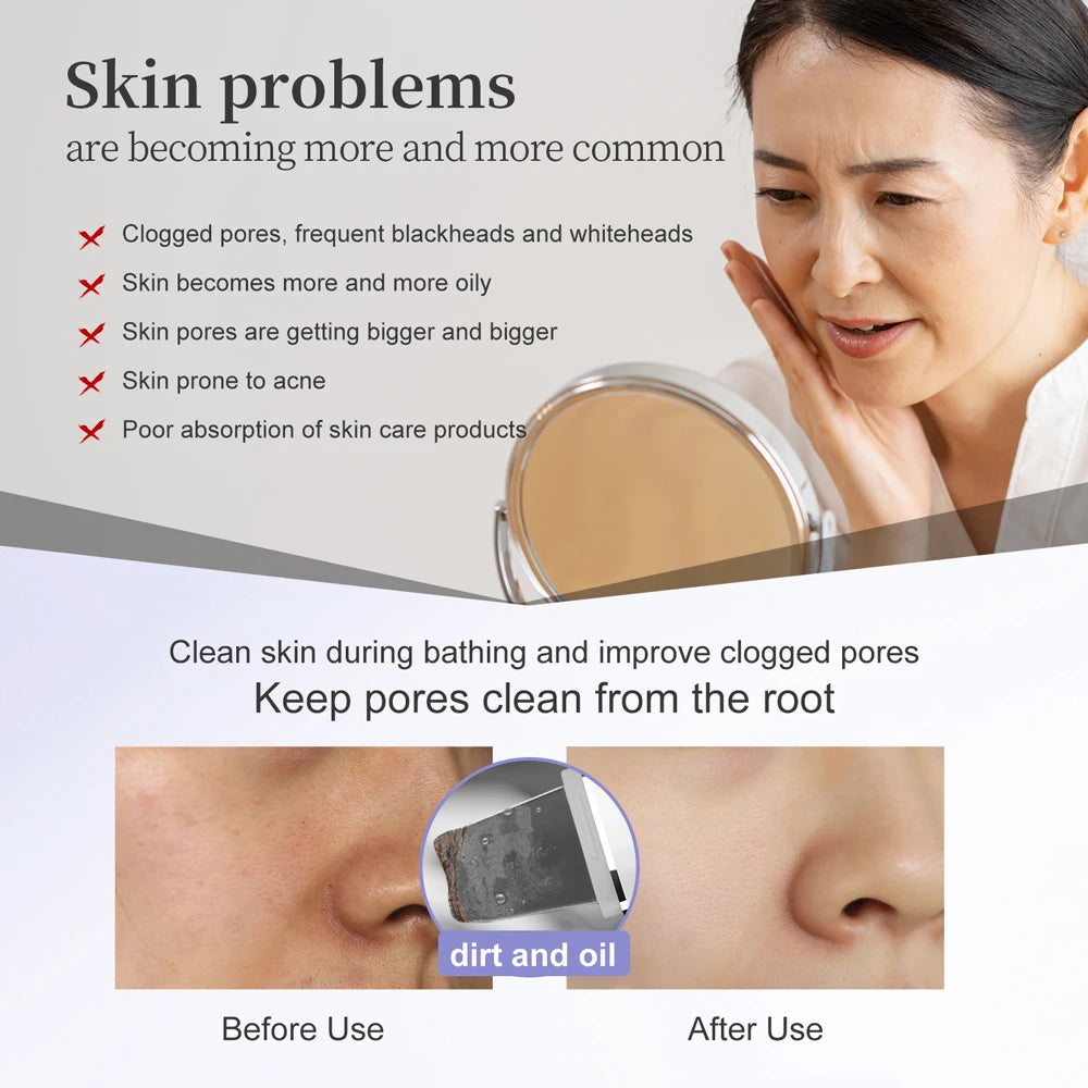 Skin Scrubber Peeling Facial Ultrasonic EMS Lifting Red Blue Skin Care Pore Deep Cleansing Machine IPX7