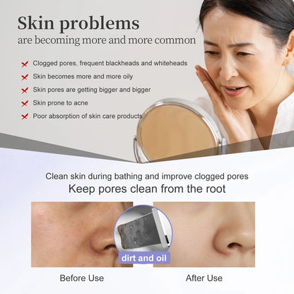 Skin Scrubber Peeling Facial Ultrasonic EMS Lifting Red Blue Skin Care Pore Deep Cleansing Machine IPX7