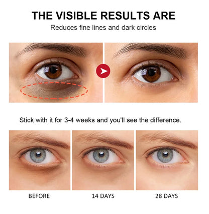 Retinol Eye Cream Lightening Dark Circles Firming Skin Instant Eye Repair Serum