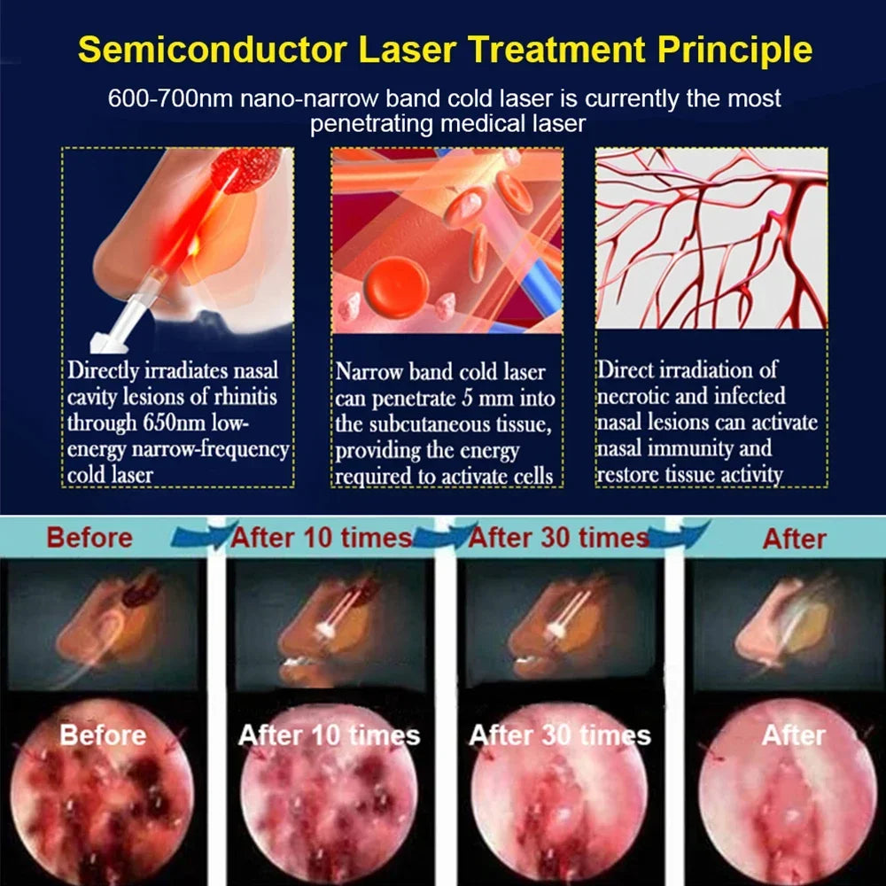 ClearBreathe Laser Therapy Device