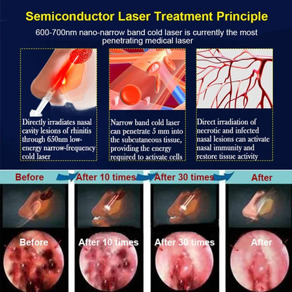 ClearBreathe Laser Therapy Device