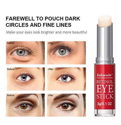 Retinol Eye Cream Lightening Dark Circles Firming Skin Instant Eye Repair Serum