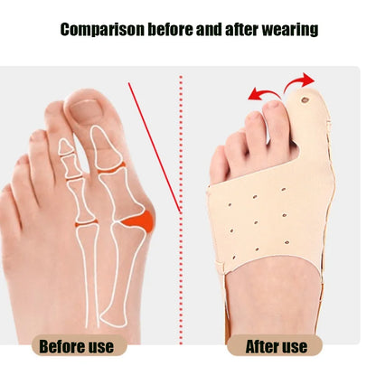 Adjustable Foot Protection Cover Thumb Outward Rotation Big Foot Bone