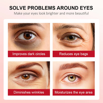Retinol Eye Cream Lightening Dark Circles Firming Skin Instant Eye Repair Serum